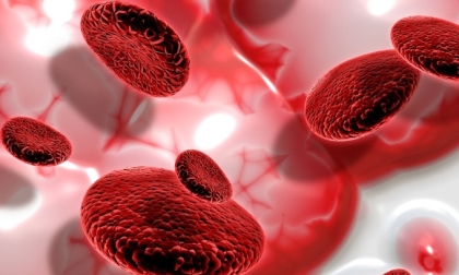 Thiếu máu nguy cơ mắc ung thư